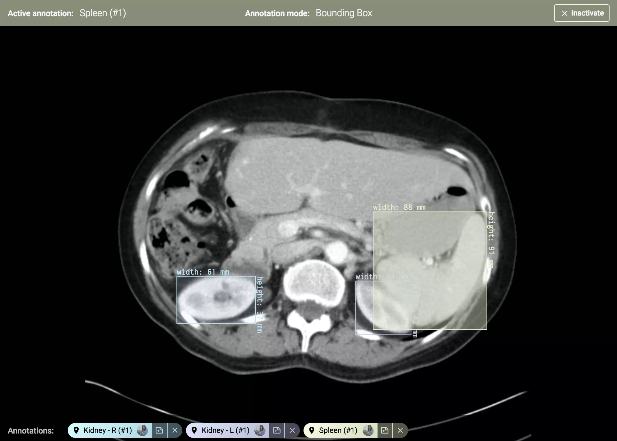 Apply Multiple Labels