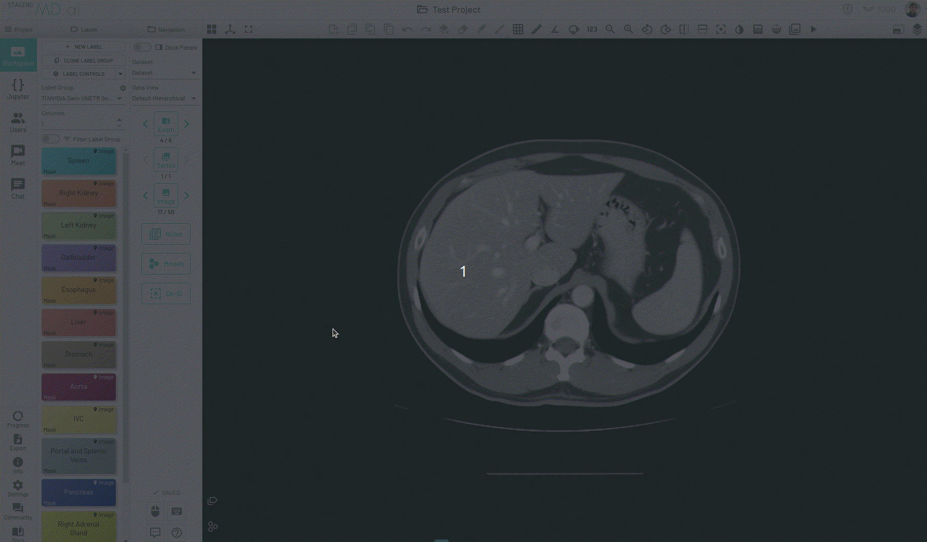 auto-segment-interpolation.gif