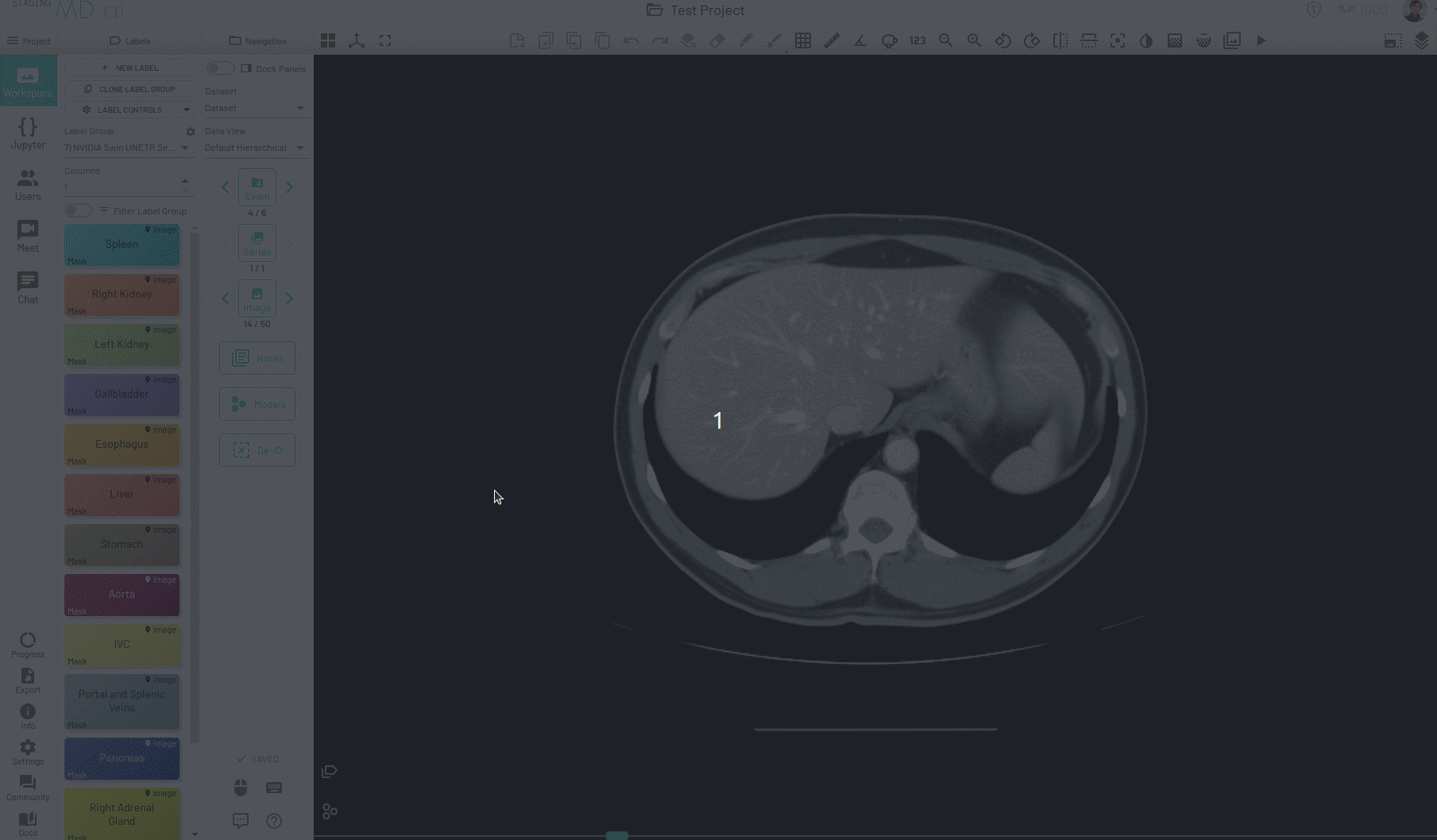 auto-segment.gif