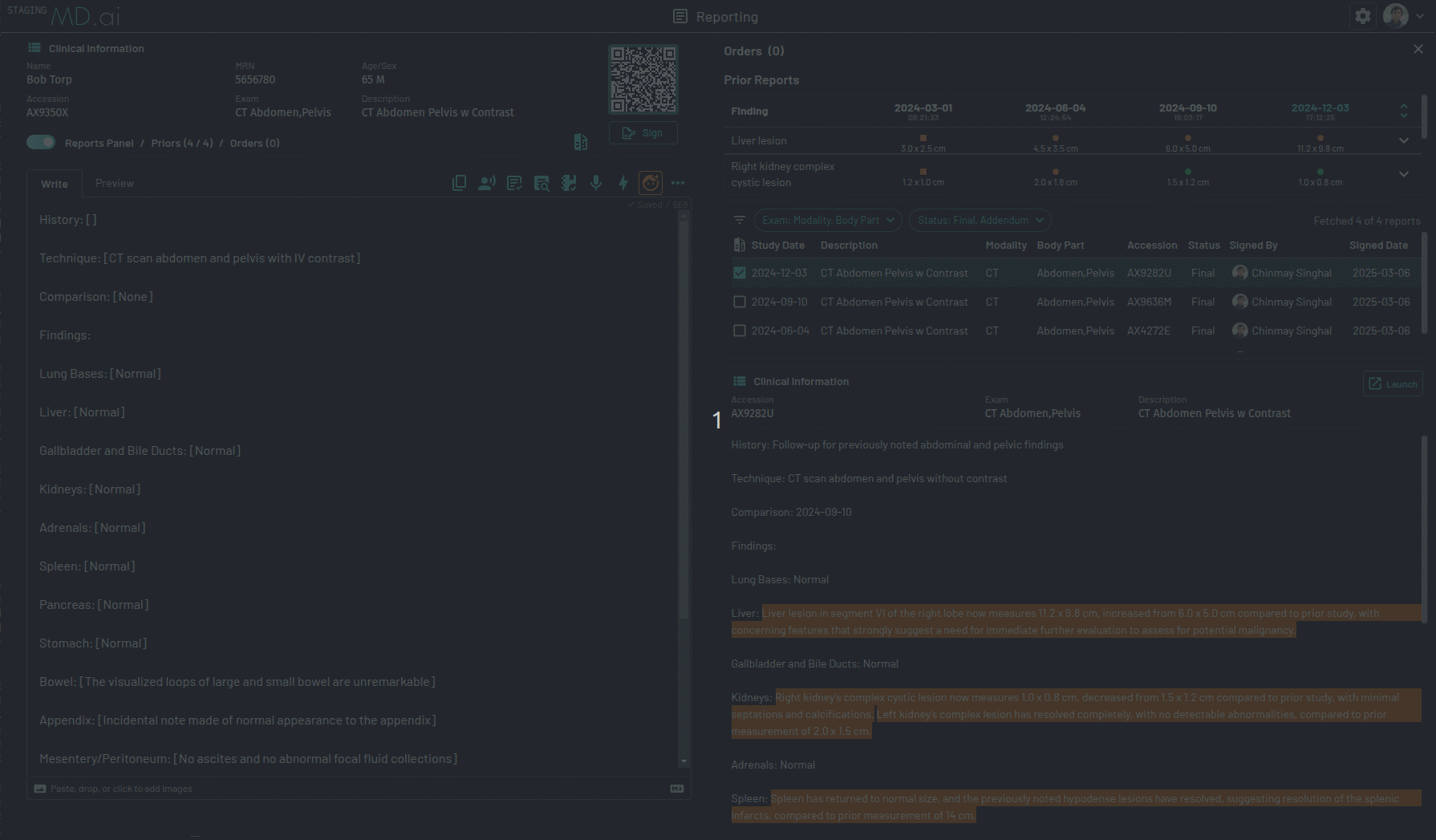 Disease tracking