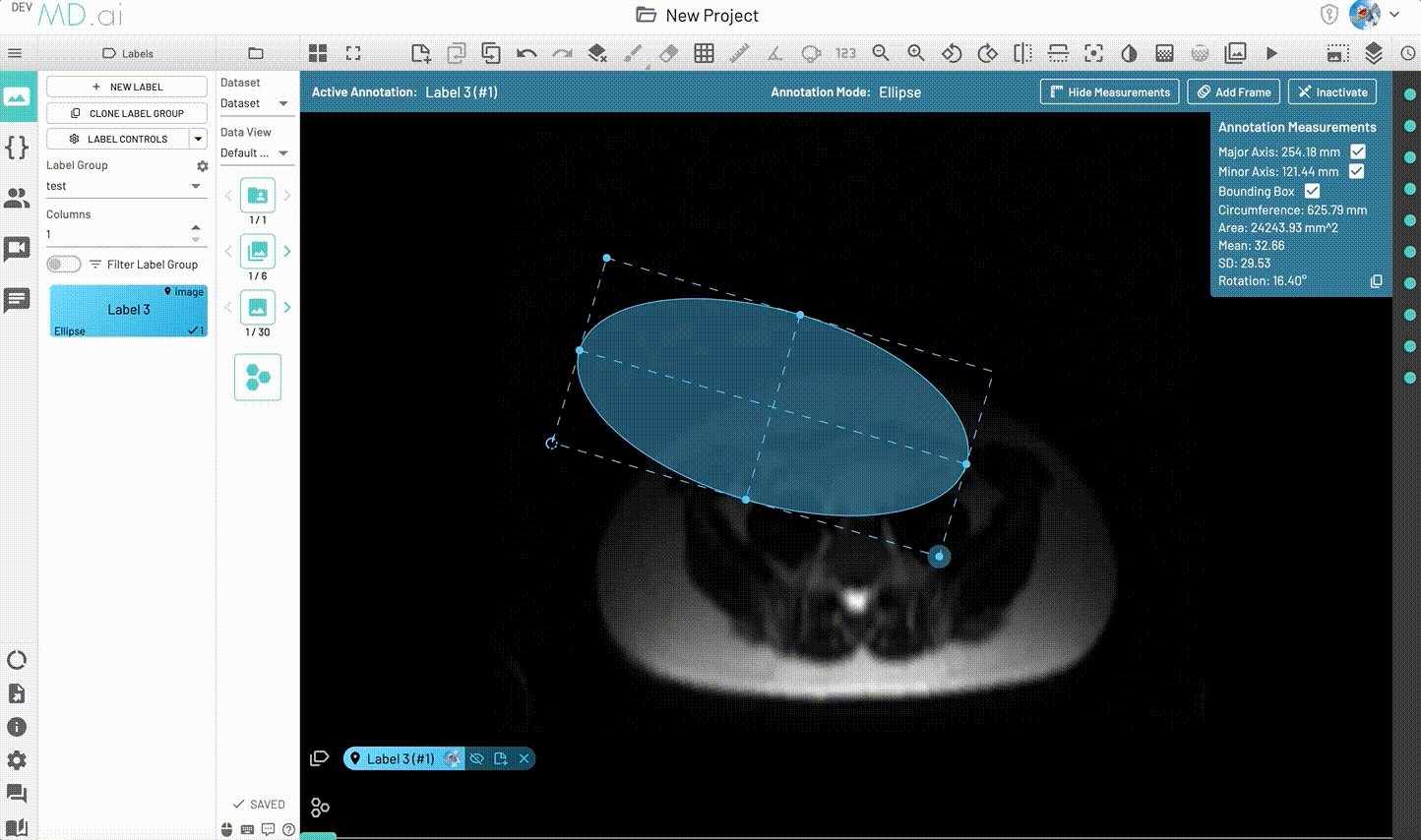 ellipse-annotation-measurements.gif