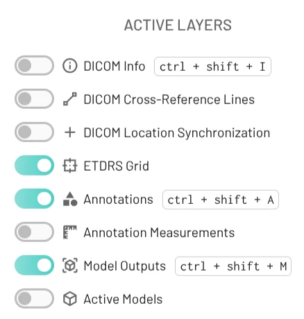 ETDRS Grid in the Layers control