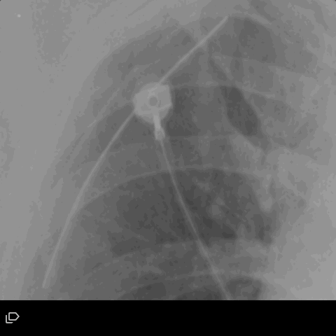 Line Annotation Angle