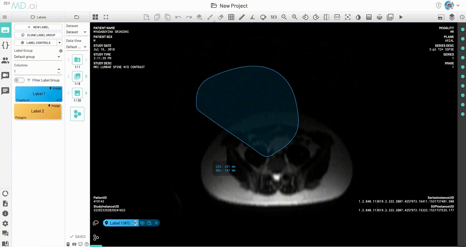 local-label-sdi.gif