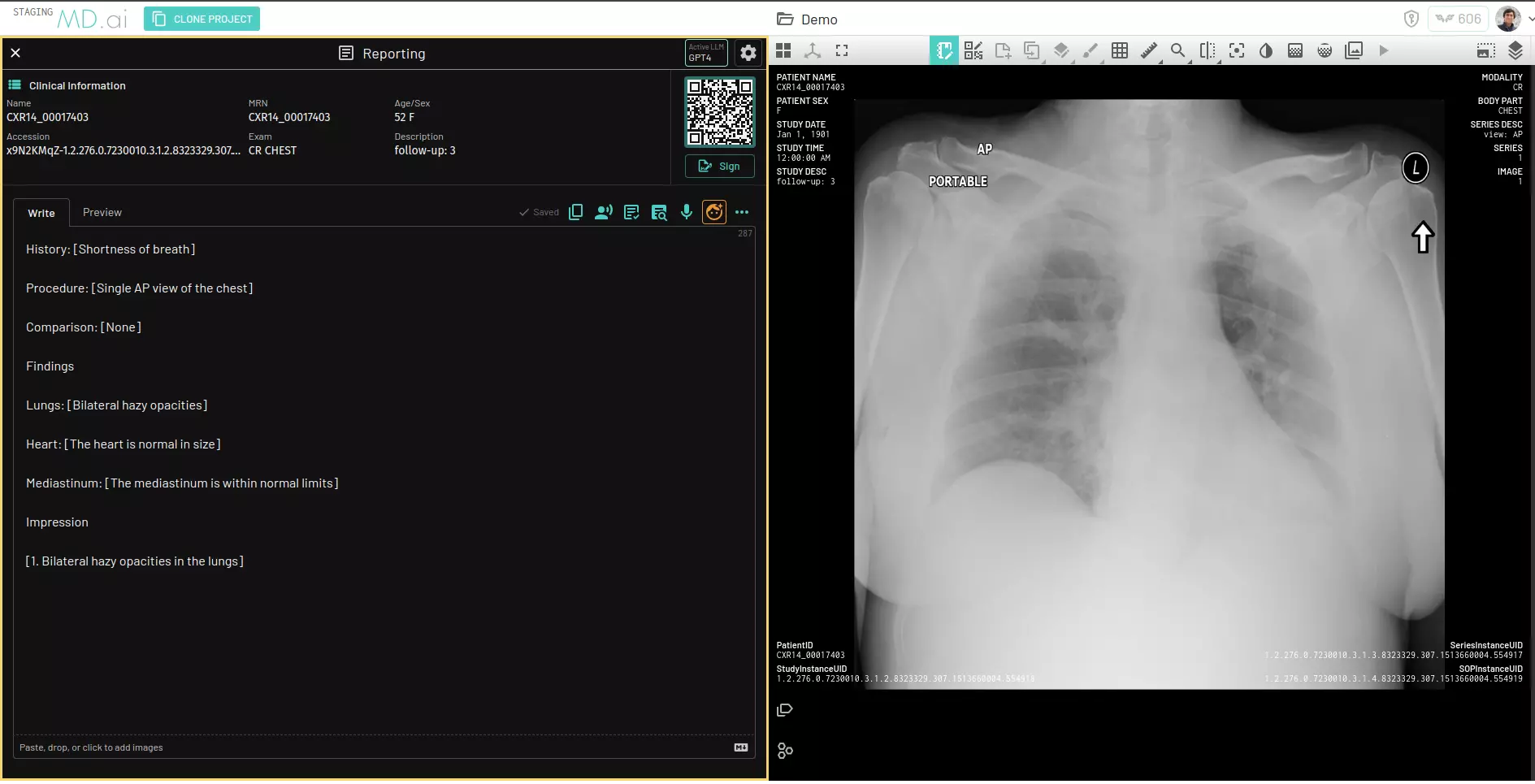 MD.ai Reporting integrated within MD.ai's DICOM viewer