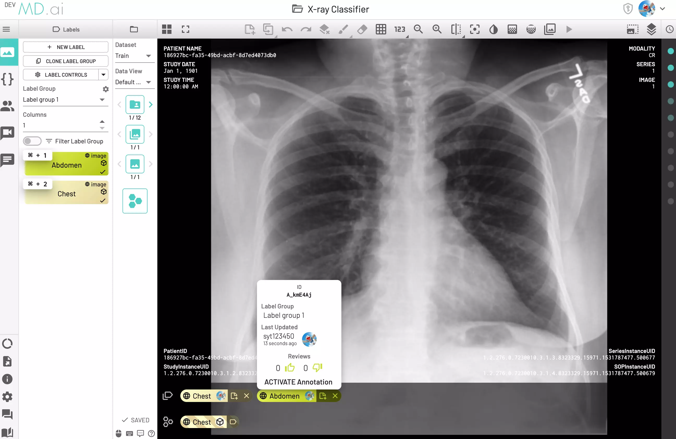 model-performance-multiple-annotations.webp