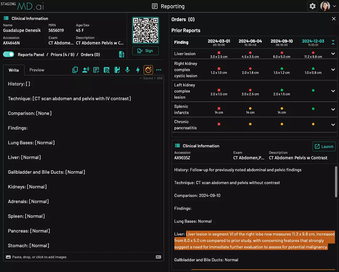 Reporting UI