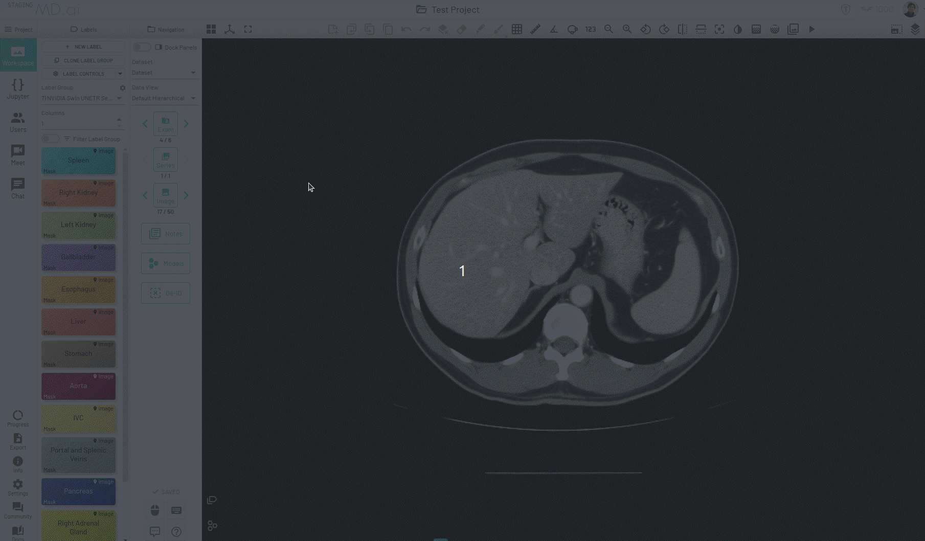 smart-tracking.gif
