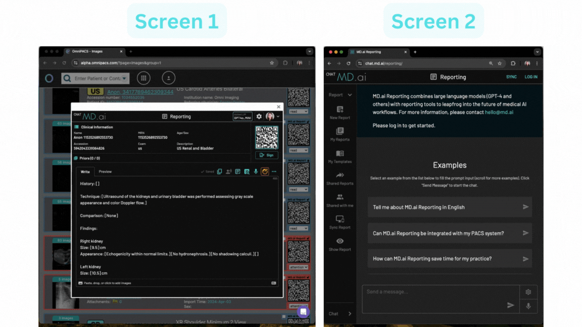 Sync remote