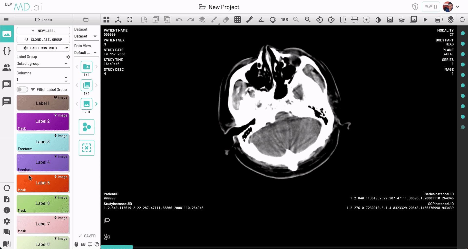 Automated Annotation