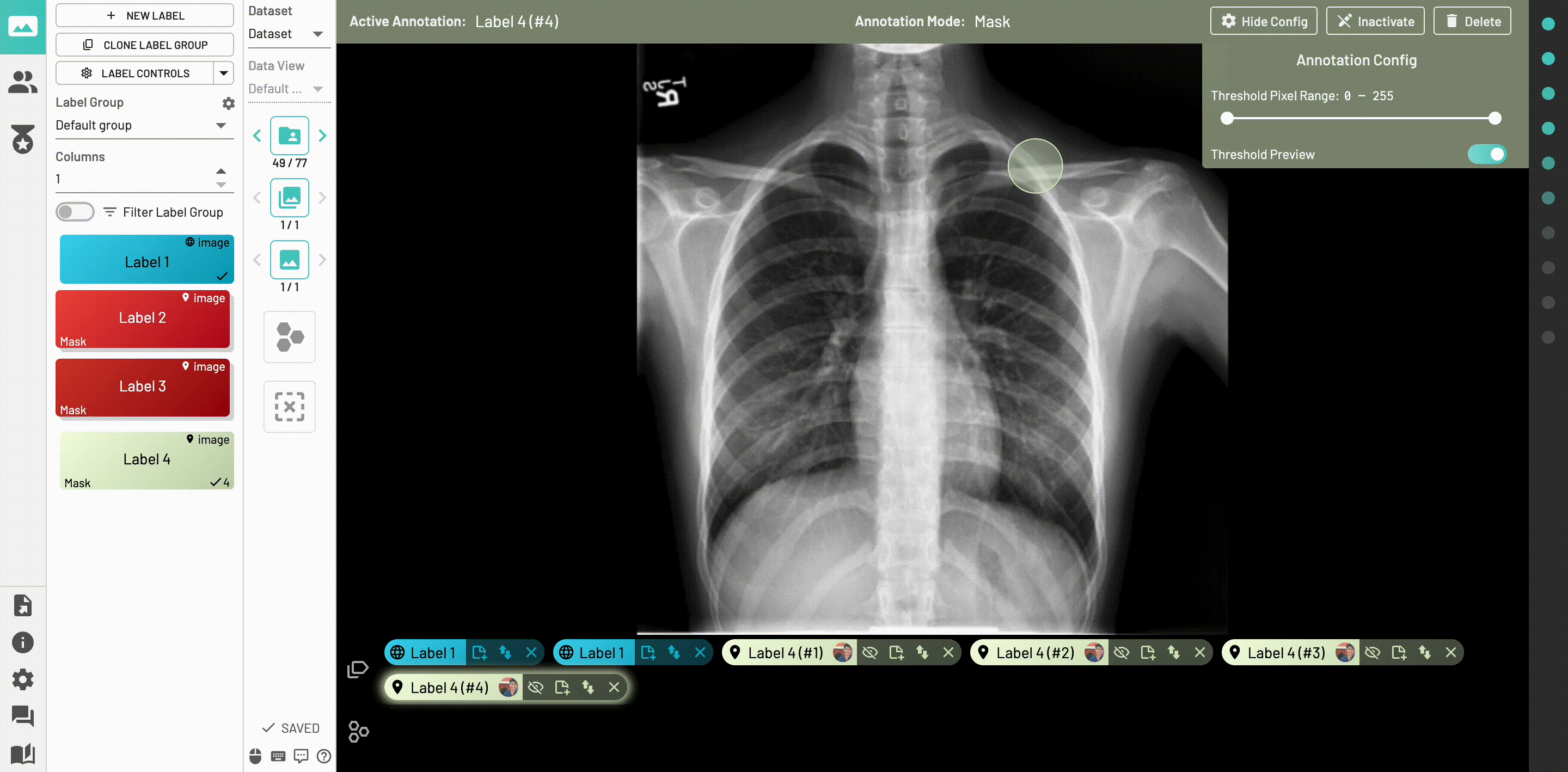 Toggle Threshold Preview